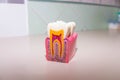 Tooth model without caries, tooth decay in dentist`s office. Healthy teeth concept . children`s dentist. Copy space Royalty Free Stock Photo