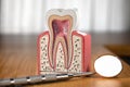 Tooth model cross section with dental mirror tool on wooden table. Close up. Dental treatment and hygiene concept