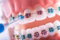 Tooth model from dental braces with inter dental teeth cleaning brush