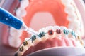 Tooth model from dental braces with inter dental teeth cleaning brush