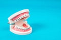 Tooth model with metal wire dental braces Royalty Free Stock Photo