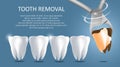 Tooth removal vector medical poster banner template Royalty Free Stock Photo