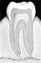 Tooth - In Situ Cross Section