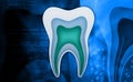tooth structure Royalty Free Stock Photo
