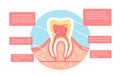 Tooth structure vector concept Royalty Free Stock Photo