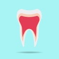 Tooth wear brace on the blue background