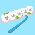 Tooth wear brace with brush Royalty Free Stock Photo