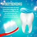 Tooth whitening 1