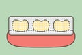 tooth whitening, yellow tooth used teeth whitening strip to whiten - dental cartoon vector flat style Royalty Free Stock Photo