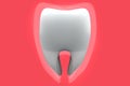 Toothache concept, caries concept isolated on red background. 3D rendering