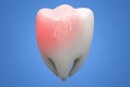 Toothache concept, human tooth with caries isolated on blue background. 3D rendering