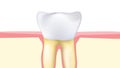 Toothache. pain of the Molar or premolar tooth.