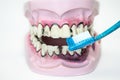 Toothbrush cleaning wooden dentures with caries and cavities on white background with copy space. Dental Health care