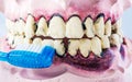 Toothbrush cleaning wooden dentures with caries and cavities on white background with copy space. Dental Health care