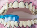 Toothbrush cleaning wooden dentures with caries and cavities on white background with copy space. Dental Health care