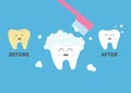 Toothbrush with toothpaste bubble foam. Healthy smiling white tooth icon. Crying bad ill yellow teeth. Before after infographic. C Royalty Free Stock Photo