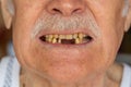 Toothless male smile mouth of senior elderly old man, dental problem, bad rotten teeth loss, caries Royalty Free Stock Photo