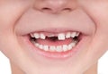Toothless smile Royalty Free Stock Photo
