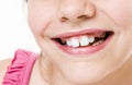 Toothless smile Royalty Free Stock Photo