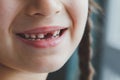 toothless smile of a girl, a baby tooth has fallen out, her face is not visible, anonymous Royalty Free Stock Photo