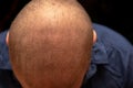 Top down view of a man`s bald head Royalty Free Stock Photo