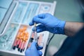 Male dentist taking painkiller injection for treatment