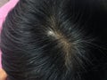 Top view close-up of gray hair of an aged Asian head