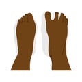 Top view comparison of healthy and deformed feet after wearing regular and barefoot shoes. Dark skin human feet.