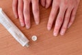 Crop crose up female hands with chilblain placed on wooden table near opened white tube of ointment medicine Royalty Free Stock Photo