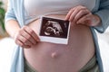 Top view cropped of pregnant woman with ultrasound photo of fetus standing at home, young future mom waiting child first Royalty Free Stock Photo