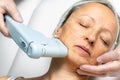 Top view of middle aged woman having skin tightening ultrasound treatment on chin