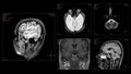 Head MRI scan from different angles