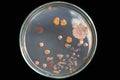 Top view soil microorganisms Nutrient agar in plate on black background Royalty Free Stock Photo