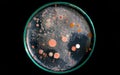 Top view soil microorganisms Nutrient agar in plate on black background