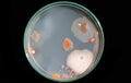 Top view soil microorganisms Nutrient agar in plate on black background