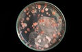 Top view soil microorganisms Nutrient agar in plate on black background