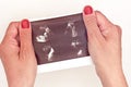 Top view of woman hand holding ultrasound picture of baby