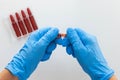 Top view of woman hands in medical glove opening ampoule with vitamin group B for injection on the white background