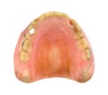 Top view worn denture teeth