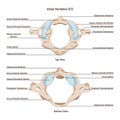 Topmost or atlas vertebra. First cervical vertebra connecting the skull