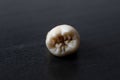 Torn out human tooth. Caries close-up. Tooth loss. Torn tooth on a black background