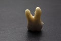 Torn out human tooth. Root up. Tooth close-up