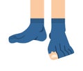 Torn sock. Leaky sock. hole in toe and finger is visible Royalty Free Stock Photo