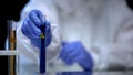 Toxic lab worker showing test-tube with biological hazard liquid, virus strain