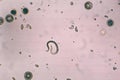 Toxocara canis and embryonated egg with larva