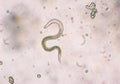 Toxocara canis second stage larvae hatch from eggs