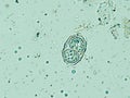 Toxoplasma gondii oocyst under the microscope, isolated