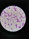 Toxoplasma gondii Tachyzoites in giemsa stained