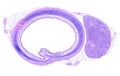 Trachea and thyroid