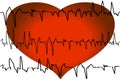 Tracing of the cardiogram with heart